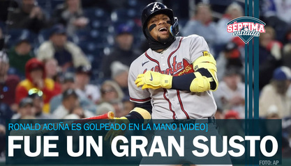 ¡Qué susto! Ronald Acuña es golpeado; rayos X salen negativos